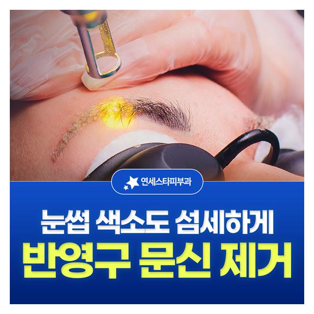 반영구 문신 제거, 눈껍 색소도 섬세하게 지우기