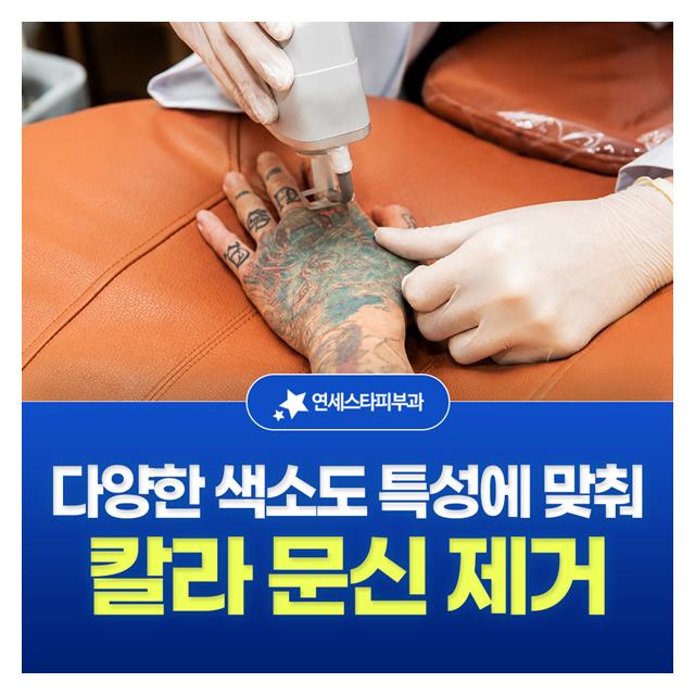 칼라 문신 제거, 다양한 색소도 특성에 맞춰 제거하도록 합니다